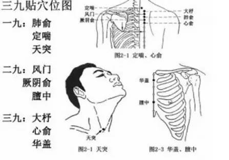 2017北京三伏贴价格及贴敷方法